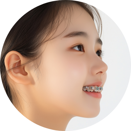 Dental Implant Process image3